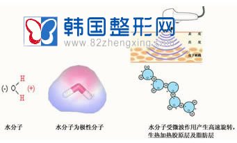 射频去除老年斑多久可以见效 