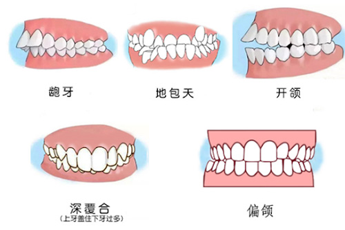 不同的口腔问题