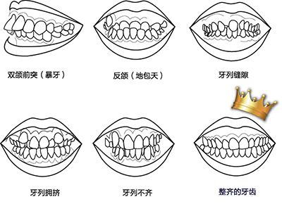 牙齿情况