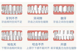 牙齿畸形.jpg