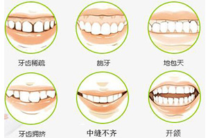 需要做牙齿矫正的情况？