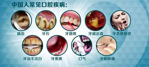 国内常见口腔疾病