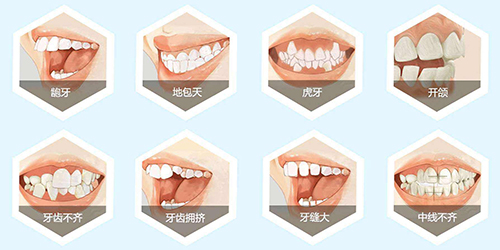 需要进行牙齿矫正的情况