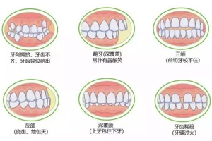 牙齿不齐.jpg